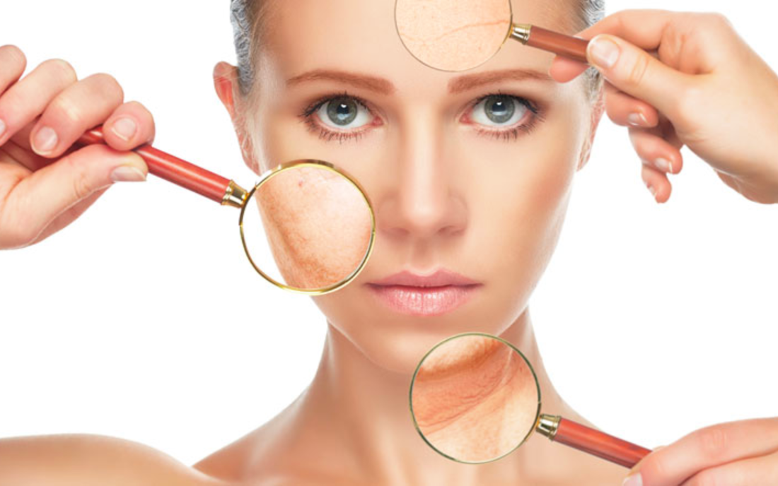 dermatologia acne cicatrices queloides laser dermatologo psoriasis tratamiento dermatologico dermatologa lleida dermatologo lleida cicatriz con queloide granos en la cara